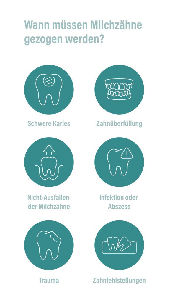 PAN-infografik Milchzahn