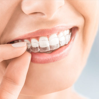 Invisalign in der PAN Klinik bei Ihrem Zahnarzt Köln